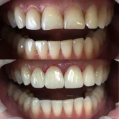 стоматологическая клиника natura smile dental clinic изображение 7 на проекте schukino.su