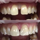 стоматологическая клиника natura smile dental clinic изображение 8 на проекте schukino.su