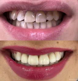 стоматологическая клиника natura smile dental clinic изображение 2 на проекте schukino.su