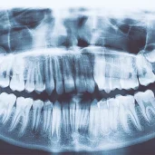 стоматологическая клиника самсон-дента изображение 5 на проекте schukino.su