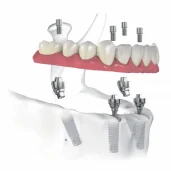 стоматологическая клиника самсон-дента изображение 7 на проекте schukino.su